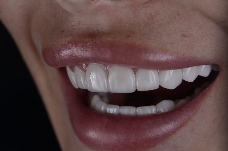 Каннаев Рабадан Гасанович - стоматолог ортопед имплантолог Ростов-на-Дону